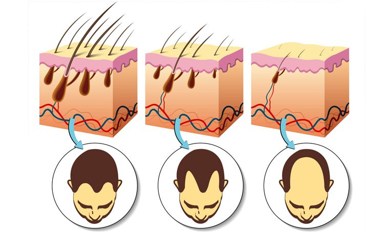 hair-loss-anatomy_nj4hxb